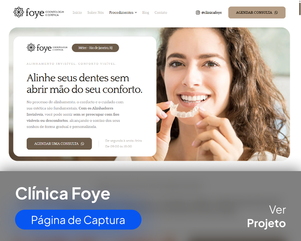 Foye